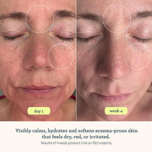 ABC Microbiome Calming Lotion