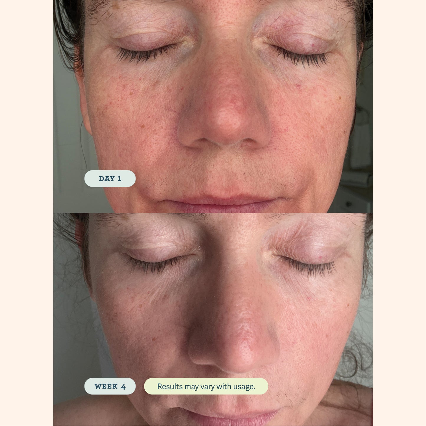 ABC Microbiome Calming Lotion
