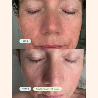 ABC Microbiome Calming Lotion
