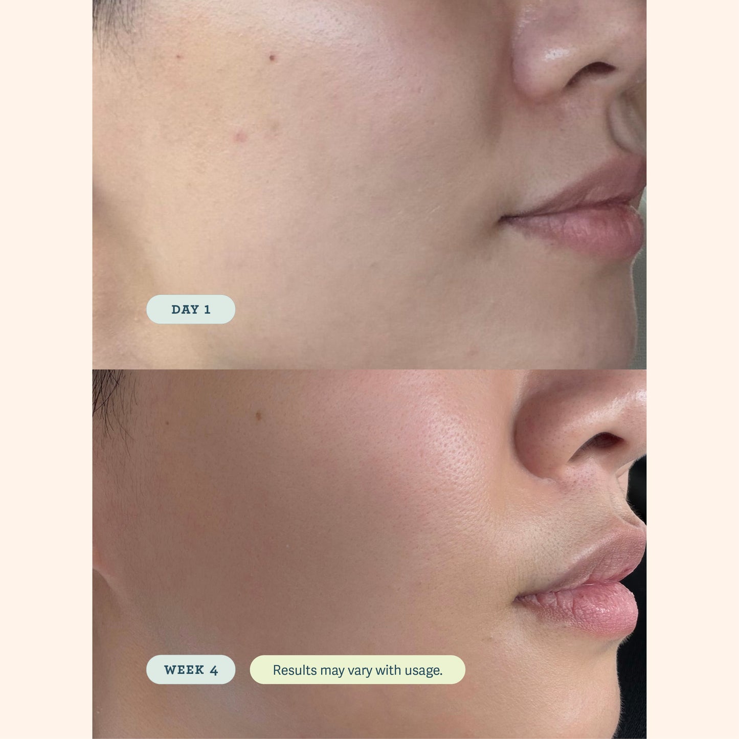 ABC Microbiome Calming Lotion