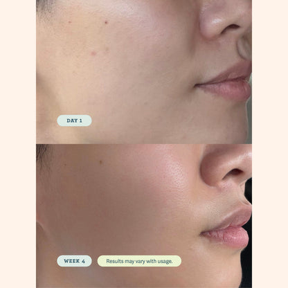 ABC Microbiome Calming Lotion