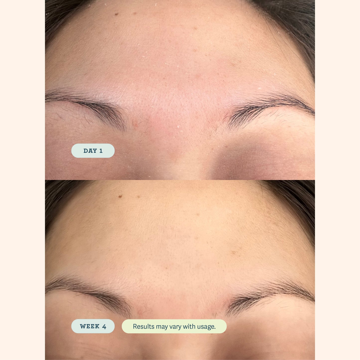 ABC Microbiome Calming Lotion