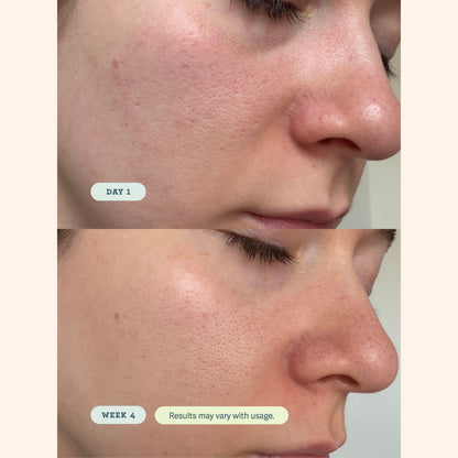 ABC Microbiome Calming Lotion