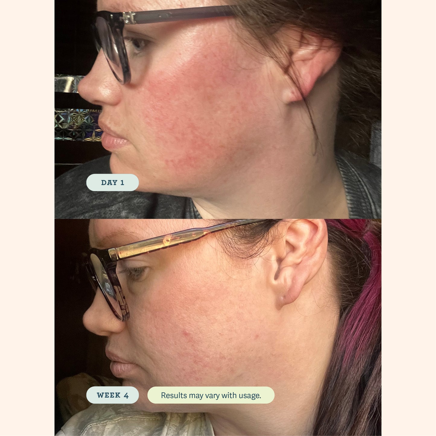 ABC Microbiome Calming Lotion