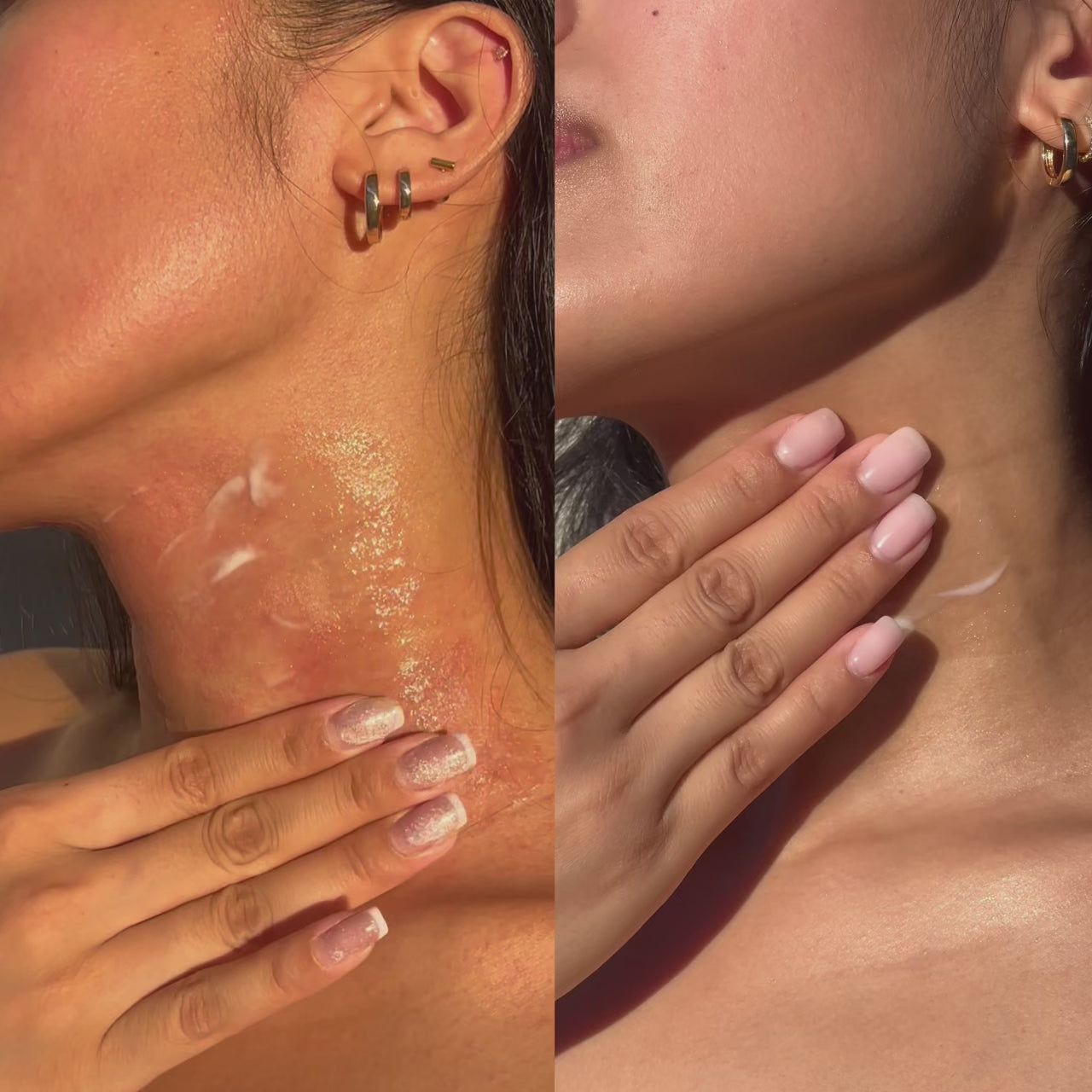Split-screen before-and-after of eczema-prone neck skin, showing visible redness and irritation on the left and calmer, smoother-looking skin on the right, with Treats Lab ABC Microbiome Calming Lotion being applied in both.